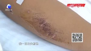 零距離·交通：醉駕男子強(qiáng)行闖卡  拖行交警數(shù)十米