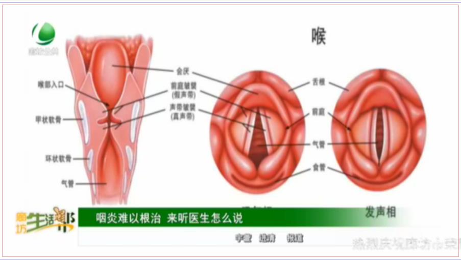 咽炎難以根治 來聽醫(yī)生怎么說